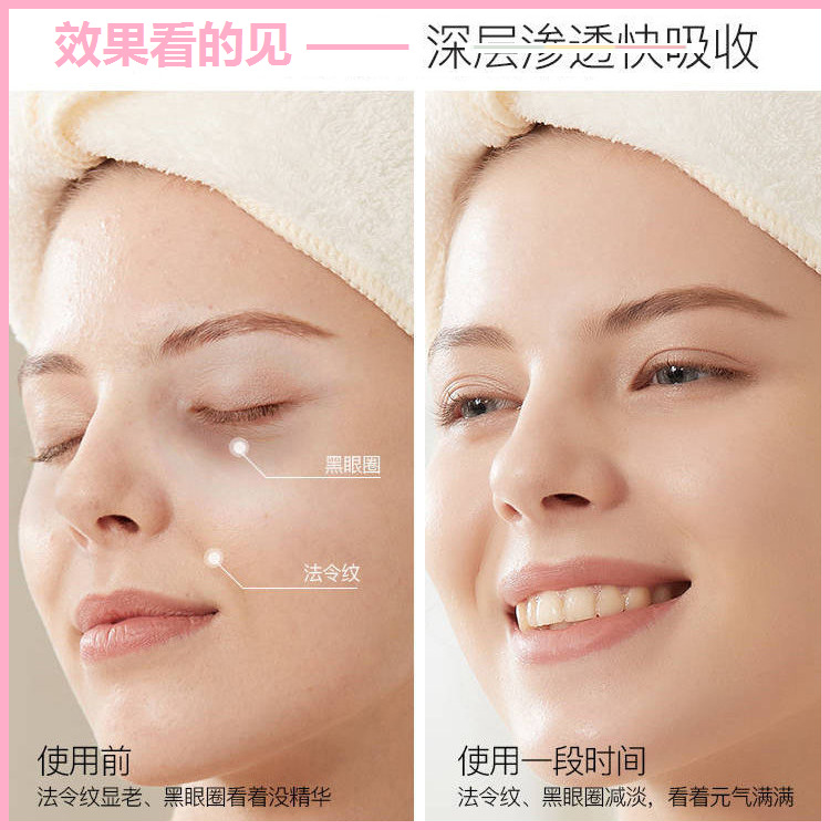 網(wǎng)紅微晶法令紋膜貼淡化細(xì)紋淡皺魔貼保濕補(bǔ)水收緊v臉提拉臉貼女OEM代加工